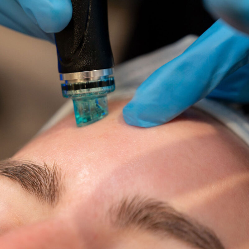 skin hydration treatment