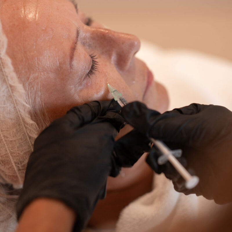 Polynucleotides Treatment for Skin Repair & Hydration